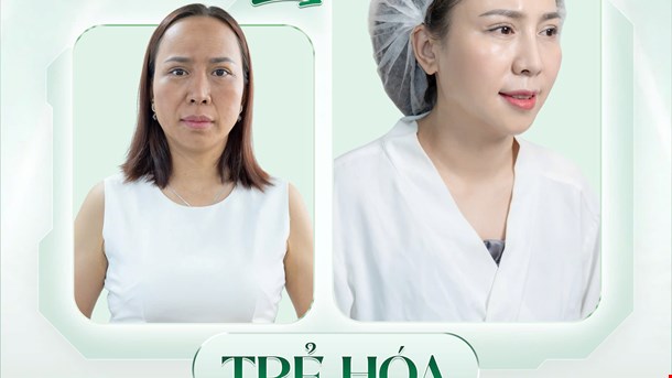 REJUVENATION WITH COLLAGEN IMPLANTATION - PAYMENT PRICE IS ONLY #299K.